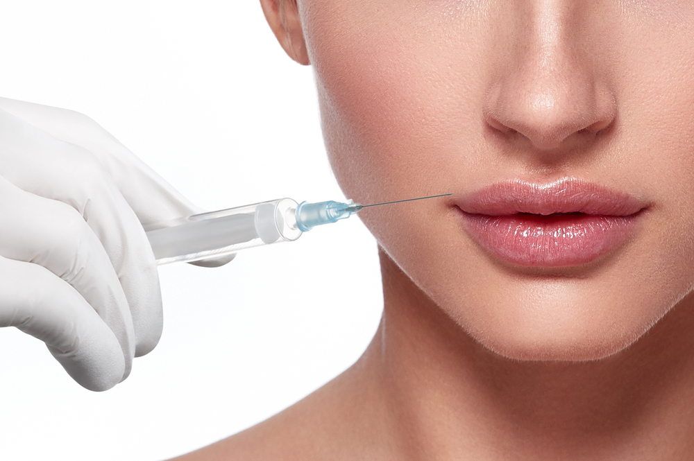 4 Reasons You May Want Lip Filler