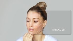 How Long Do Thread Lifts Last in Bethesda MD