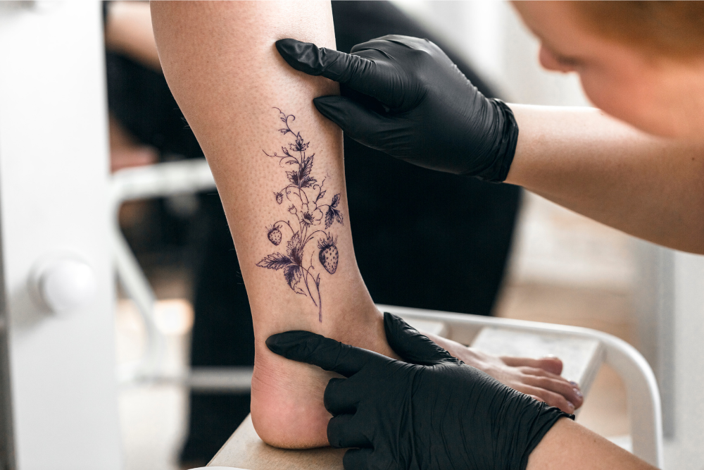 Same-Day Tattoo Removal in Olney, MD