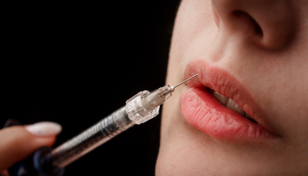 Your Guide to a Lip Filler Appointment Near DC