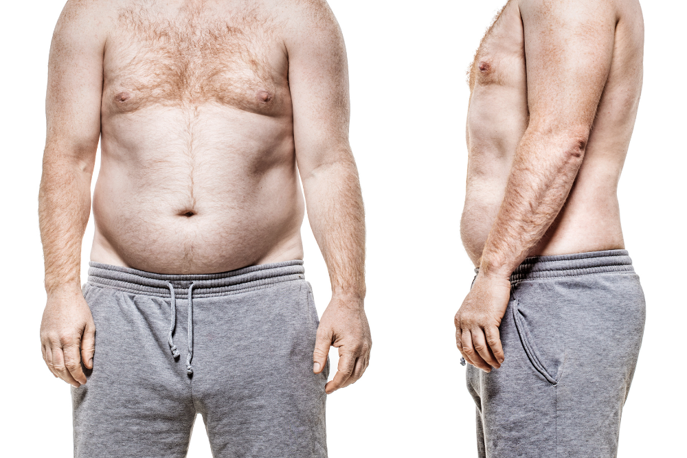 Best Weight Loss Program Near Gaithersburg, Maryland