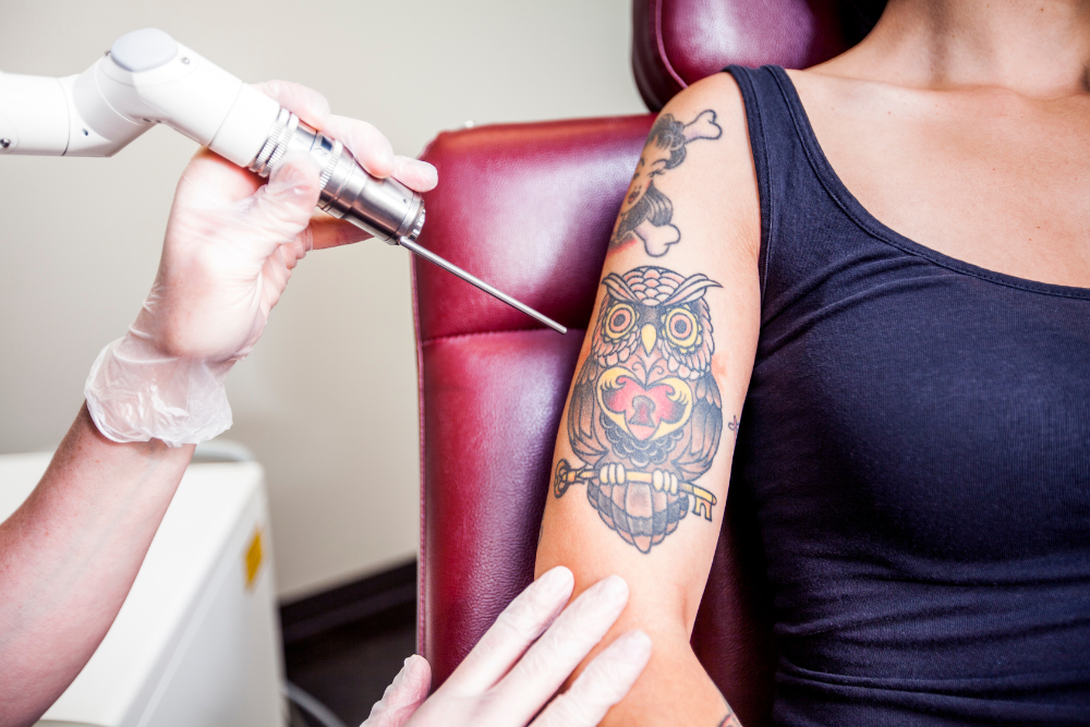 Best Tattoo Removal and Pigment Correction Pricing Near Darnestown, Maryland