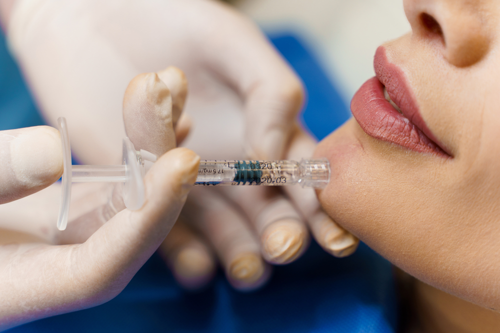 Chin Filler and Profile Balancing in Mount Pleasant Washington DC