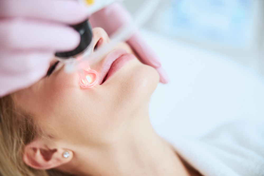 CO2 Laser Resurfacing in Potomac Maryland: Downtime, Results, and Pricing
