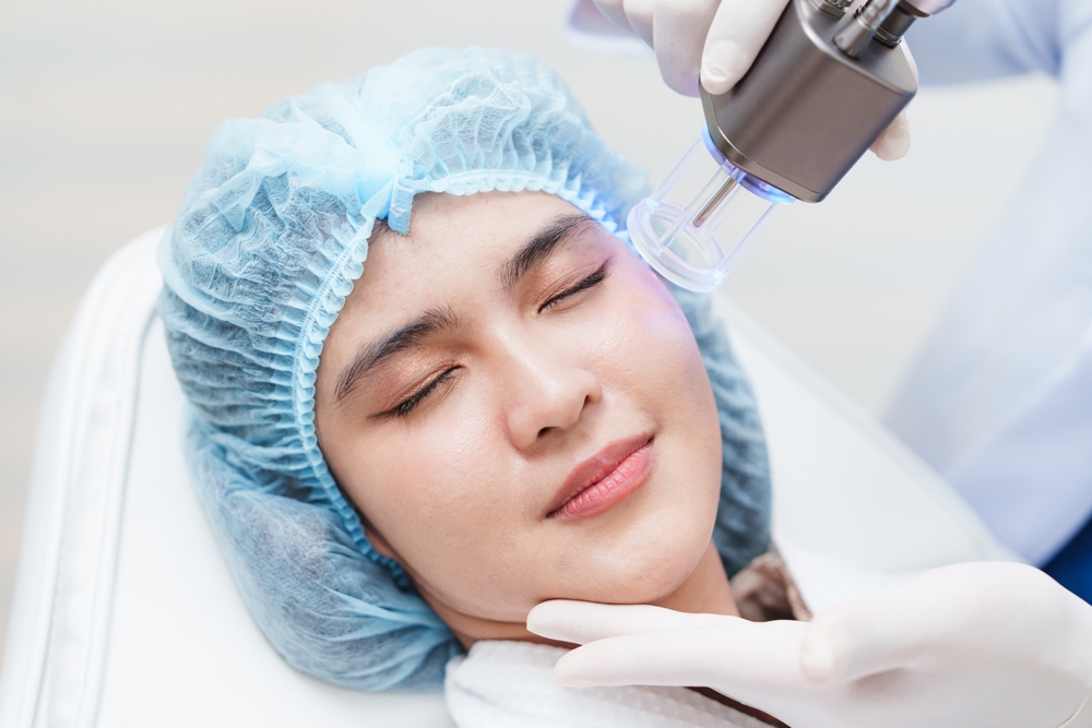 Laser Skin Resurfacing Cost in West End Washington, DC for Wrinkles and Acne Scars