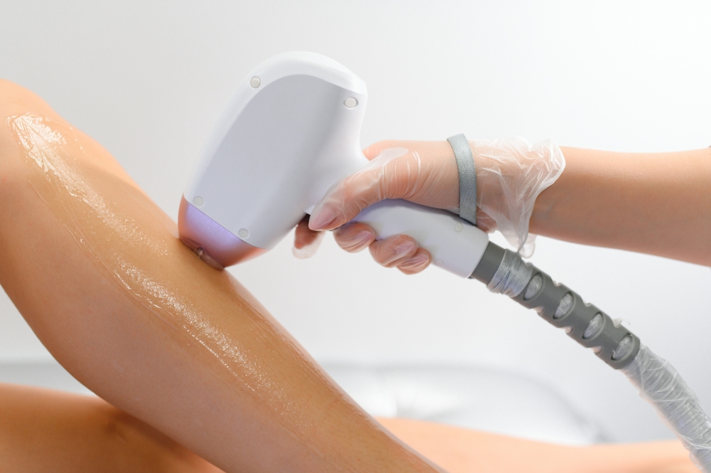 Laser Hair Removal Pricing in Navy Yard, Washington, DC: Per Session Guide