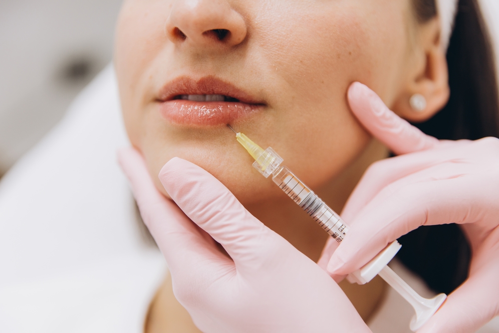 Lip Filler Near Alexandria, Virginia Natural Volume And Symmetry Results