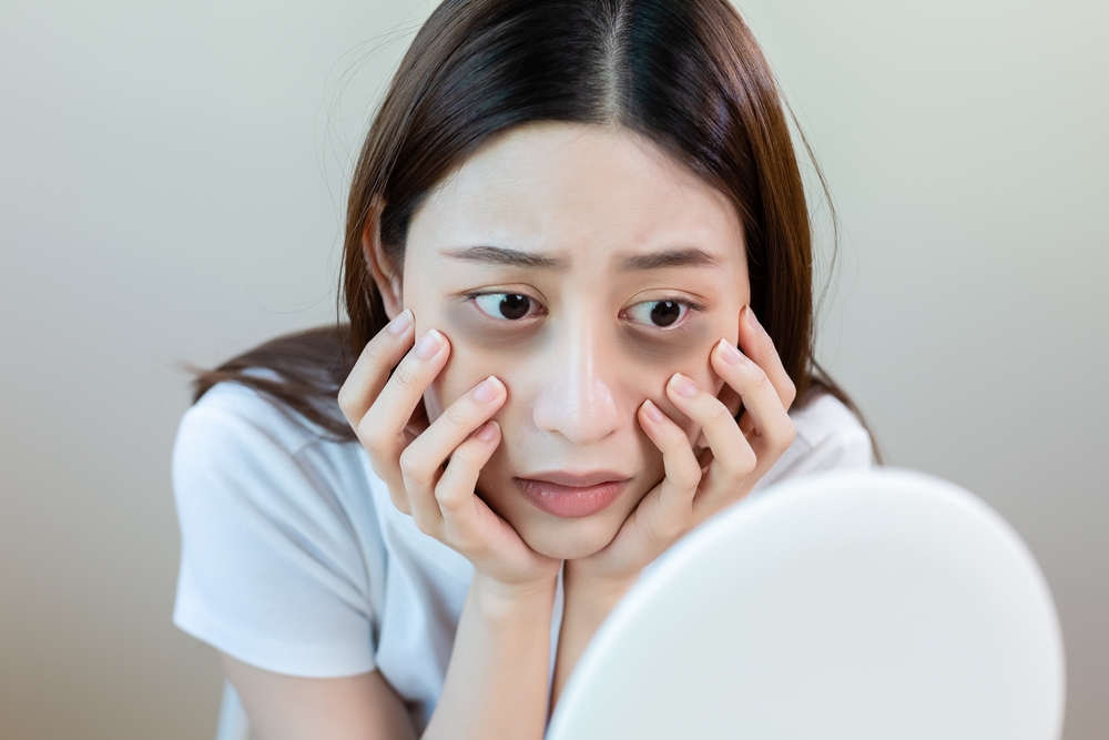 PDGF Therapy for Dark Circles and Hollow Eyes in Rockville, MD