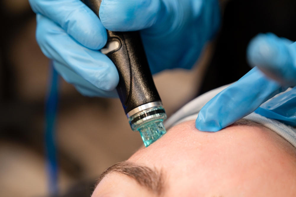 HydraFacial vs. Chemical Peel in Rockville, MD: Which Treatment Is Right for Your Skin?